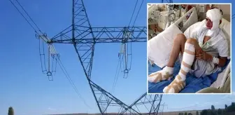 Elektrik akımına kapılan 13 yaşındaki çocuğun ayak tabanları patladı