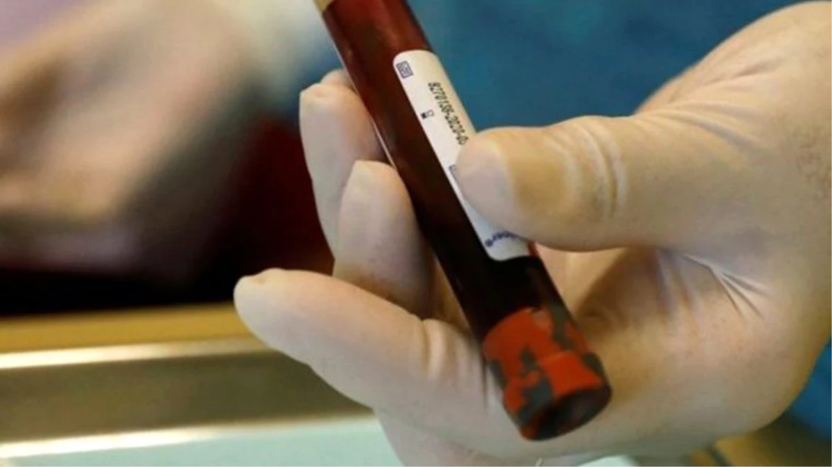 Bazı kanser türlerini belirtiler görülmeden tespit eden kan testi geliştirildi