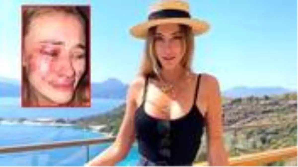 Günün iddiası: Şeyma Subaşı\'nın model arkadaşı, Türkiye\'de güvenlik görevlilerin saldırısına uğradı