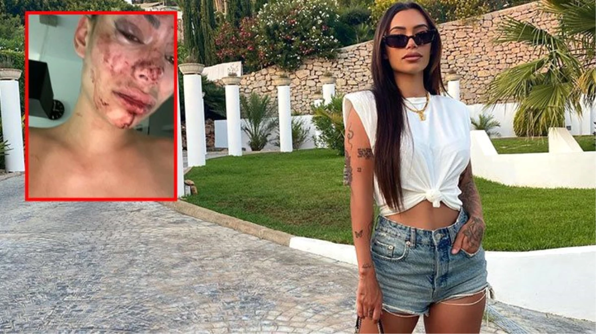 Instagram modeli Yasmine Cecilia, kendi evinde verdiği partide darp edildi! Kanlar içinde kaldı