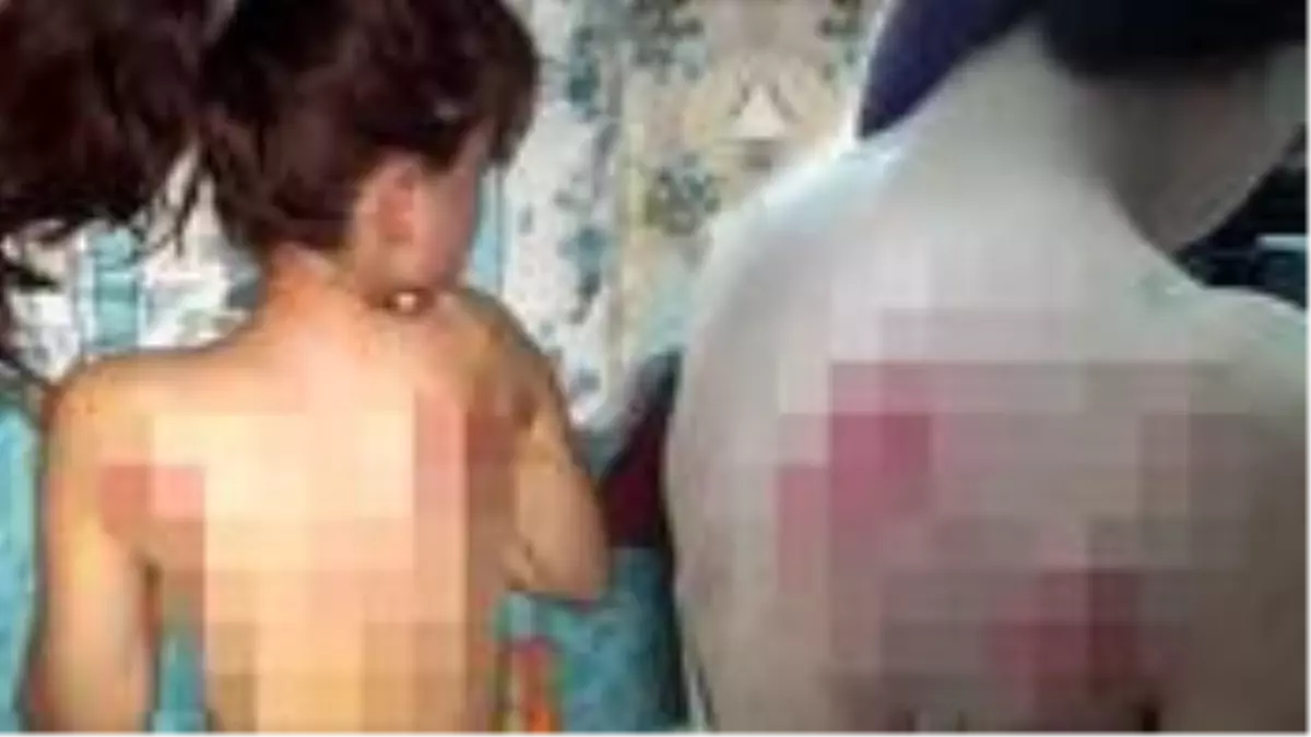 Bu nasıl baba? Telefon şifresini söylemeyen kızını, İngiliz anahtarıyla dövdü