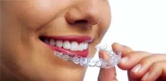 Ortodontik Tedavi Yöntemleri