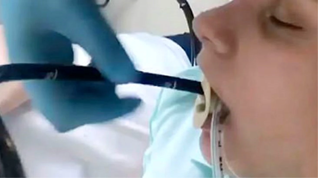 Rusya\'da uyuyan kadının ağzından giren yılan ameliyatla çıkarıldı