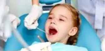 Çocuklarda fissür örtücü (diş ojesi)