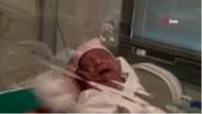 27 haftalik asena bebegin hayata tutunma mucadelesi son dakika