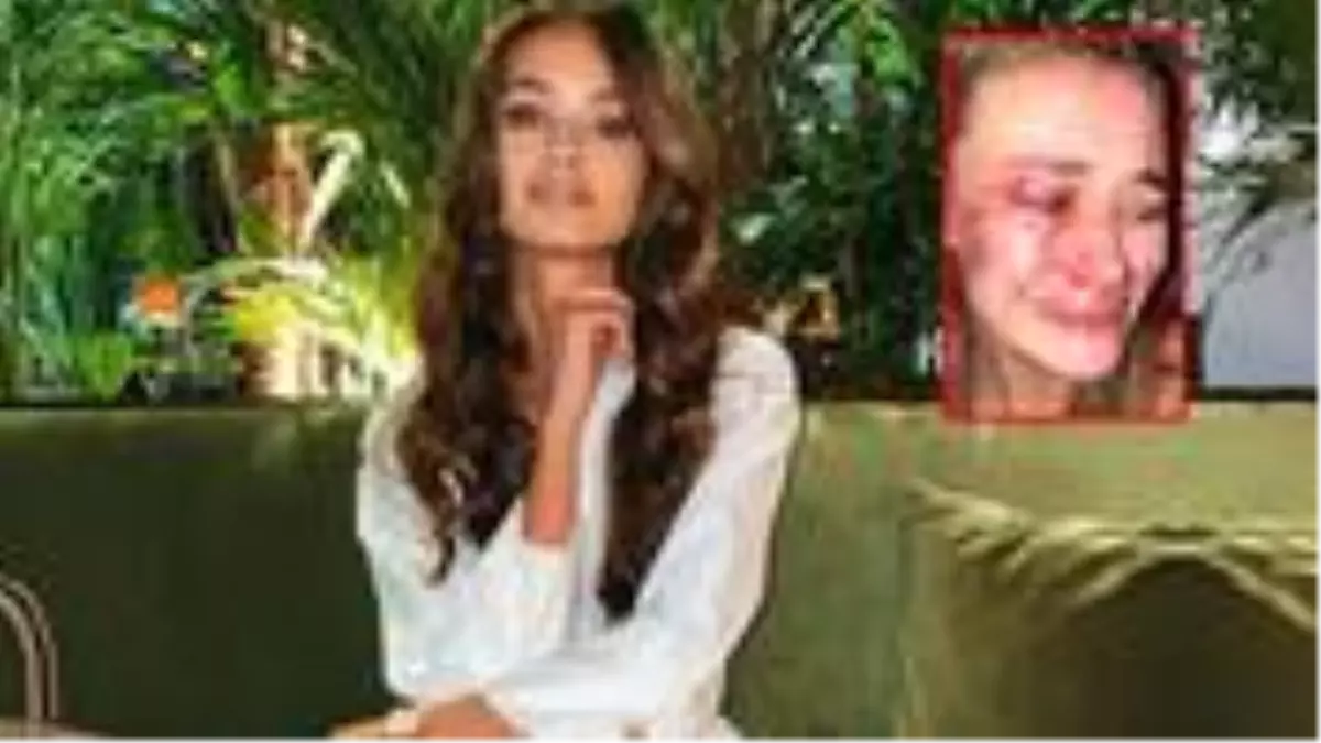 Çeşme\'de dayak yediğini söyleyen model Daria Kyryliuk, koronavirüse yakalandı