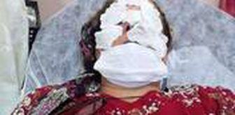 Fındık bahçesini ilaçlamak isterken zehirlenen talihsiz kadın: Yüzüme tiner atılmış gibi hissettim