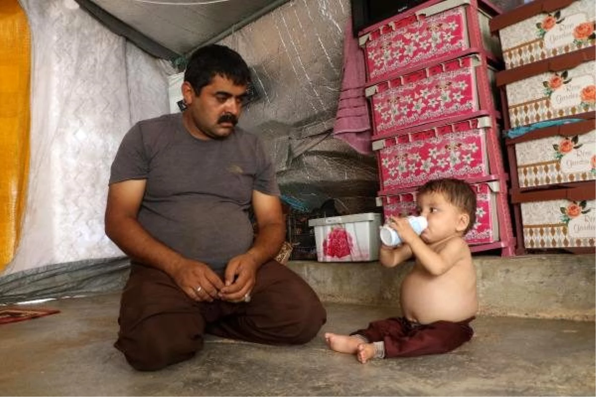 Karaciğer yetmezliği bulunan 2 yaşındaki Saad, Türkiye\'de tedavi ediliyor
