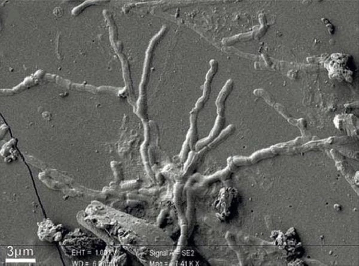 İtalya\'da 2 bin yıl önceye ait kafatasından sağlam beyin hücresi keşfedildi