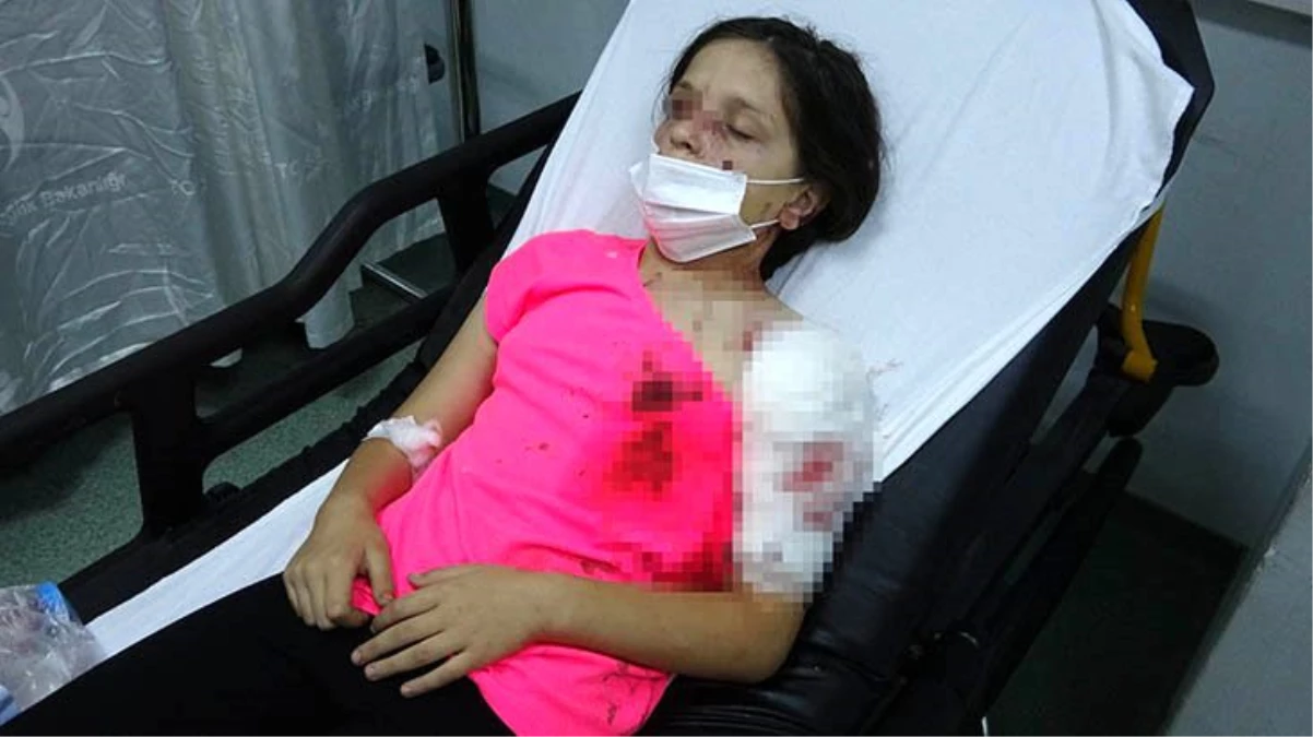 Samsun\'da pitbull dehşeti! 11 yaşındaki kız ölümden döndü