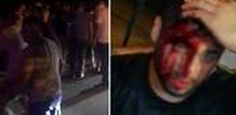 Sigara için çakmağını çakan genci kundakçı sanıp tekme tokat dövdüler