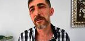 'Kavgayı ayırırken darbedildim' dedi, 3 bekçi hakkında idari soruşturma başlatıldı