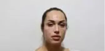 'Gençlik aşısı'nın ardından hastanelik olan Seline: Amacım yüzümü nemlendirmekti