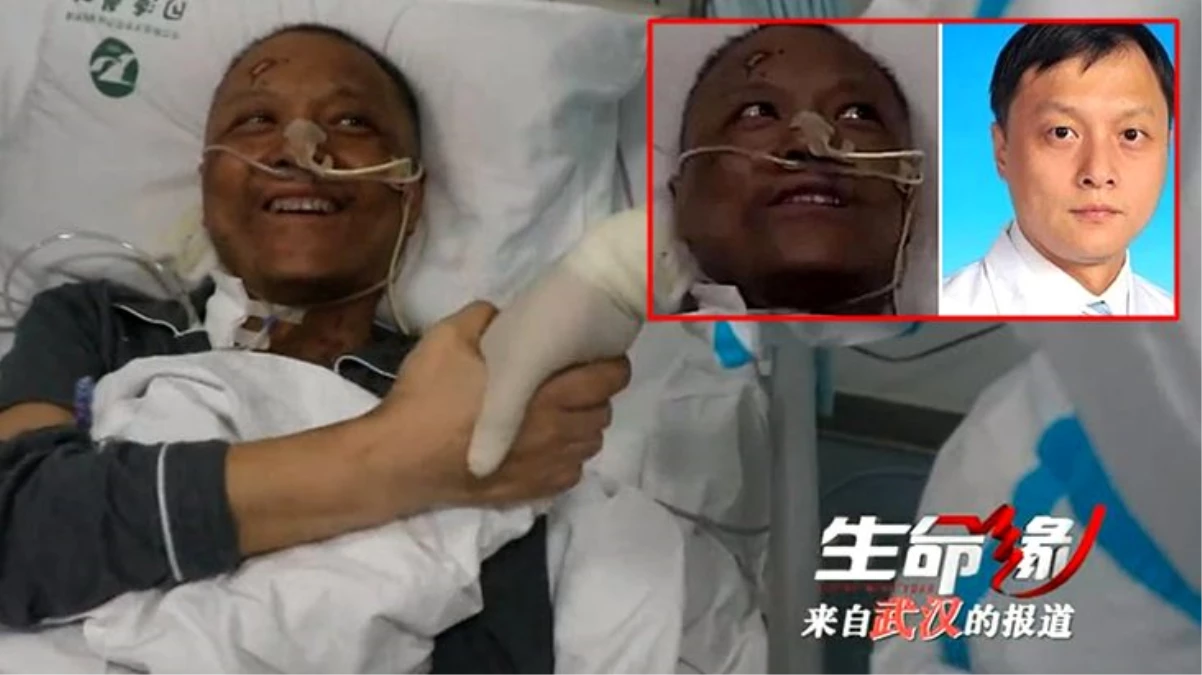 Koronavirüse yakalandıktan sonra ten rengi değişen Çinli doktor normale döndü