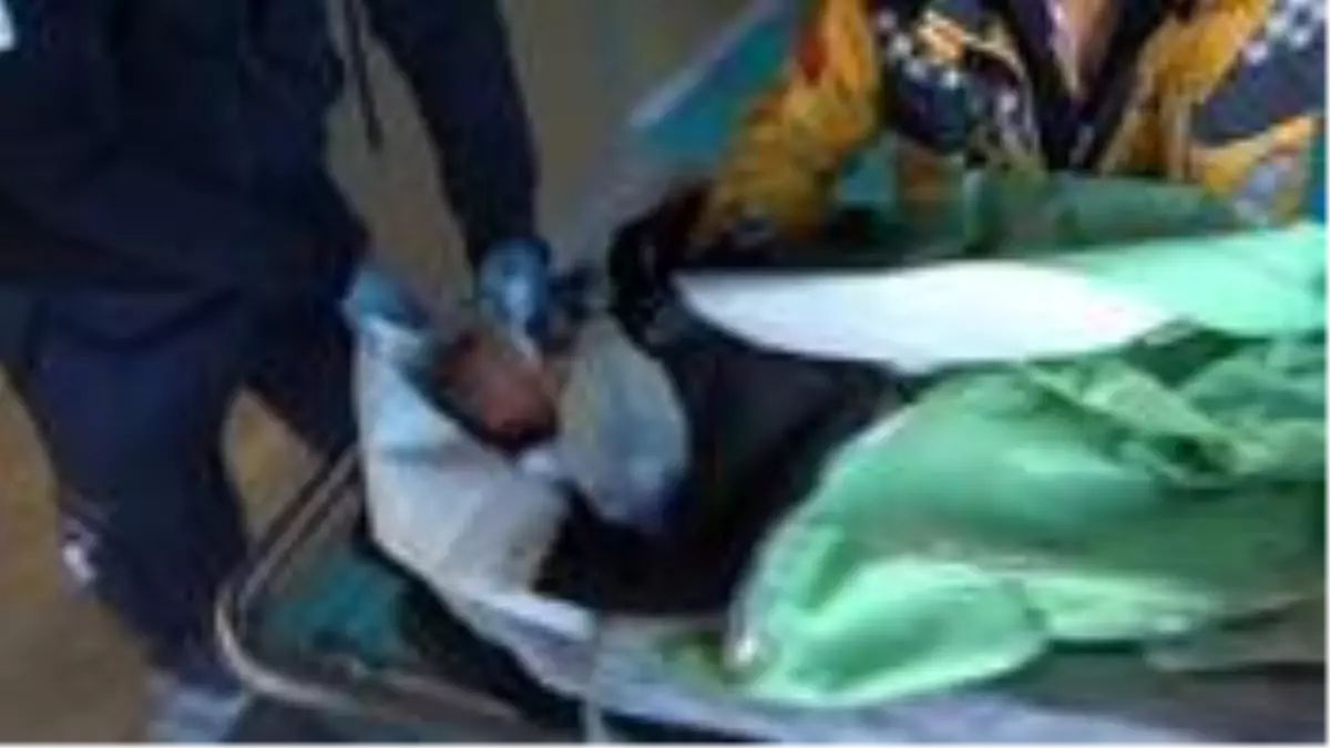 Dünyaya gözlerini açar açmaz ölüme terk edilen bebek yaşam mücadelesini kaybetti