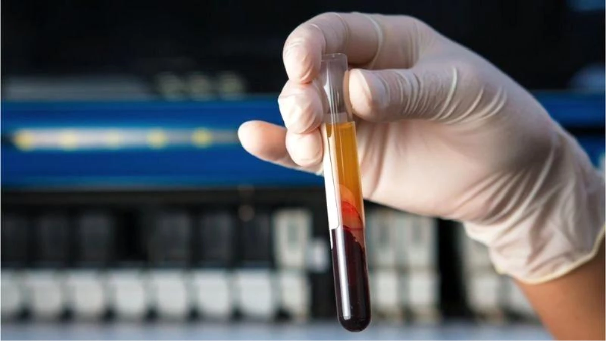 İngiltere\'de 50\'den fazla kanser türünü erken tespit etmesi umulan kan testi denenecek