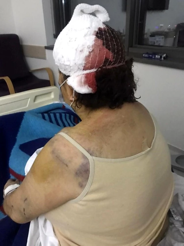 Muğla'da köpeklerin saldırısına uğrayan emekli öğretmen ağır yaralandı