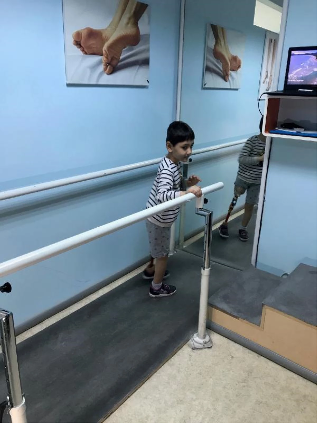 Antalyalı 7 yaşındaki Özge yeni protezine kavuştu