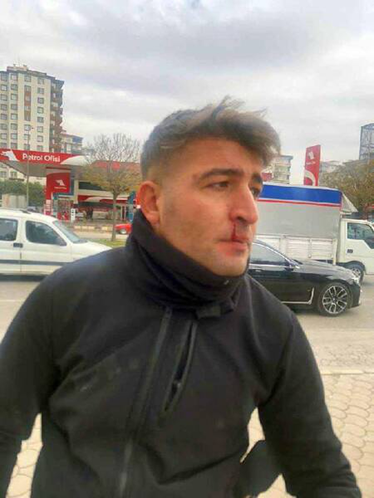 Gaziantep\'te zabıtalara bıçak ve sopalı saldırı: 2 yaralı