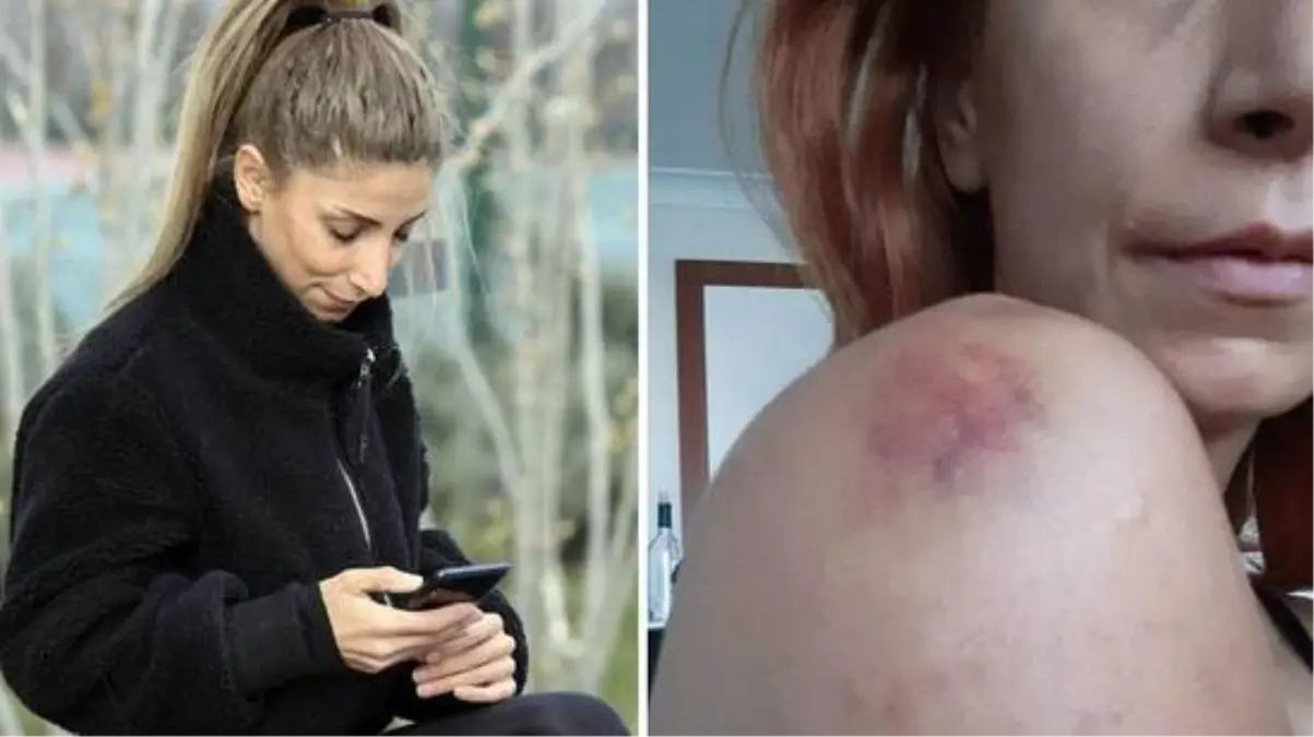 Sevgili şiddeti genç kadını canından bezdirdi: İşkence, sadistlik boyutundaydı