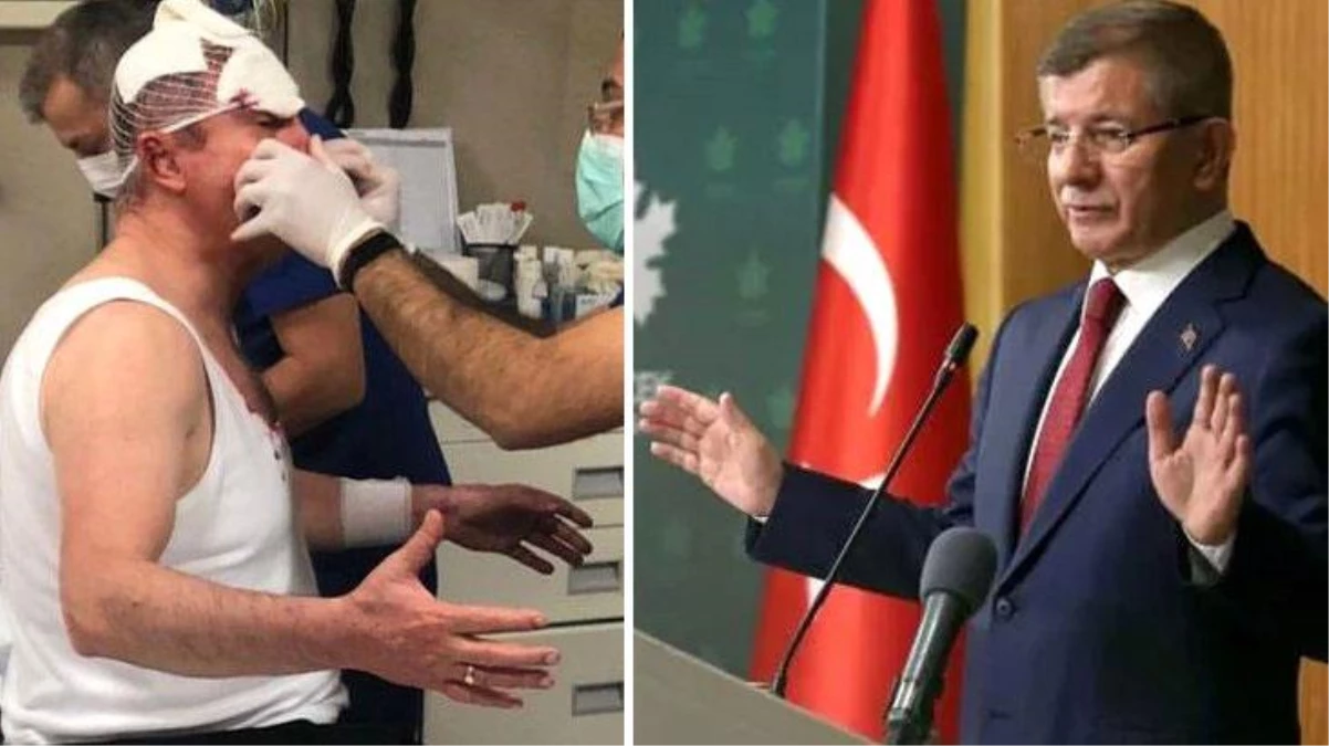 Selçuk Özdağ\'a yapılan saldırı sonrası Davutoğlu\'ndan ilk açıklama: Erdoğan\'dan açıklama bekliyoruz