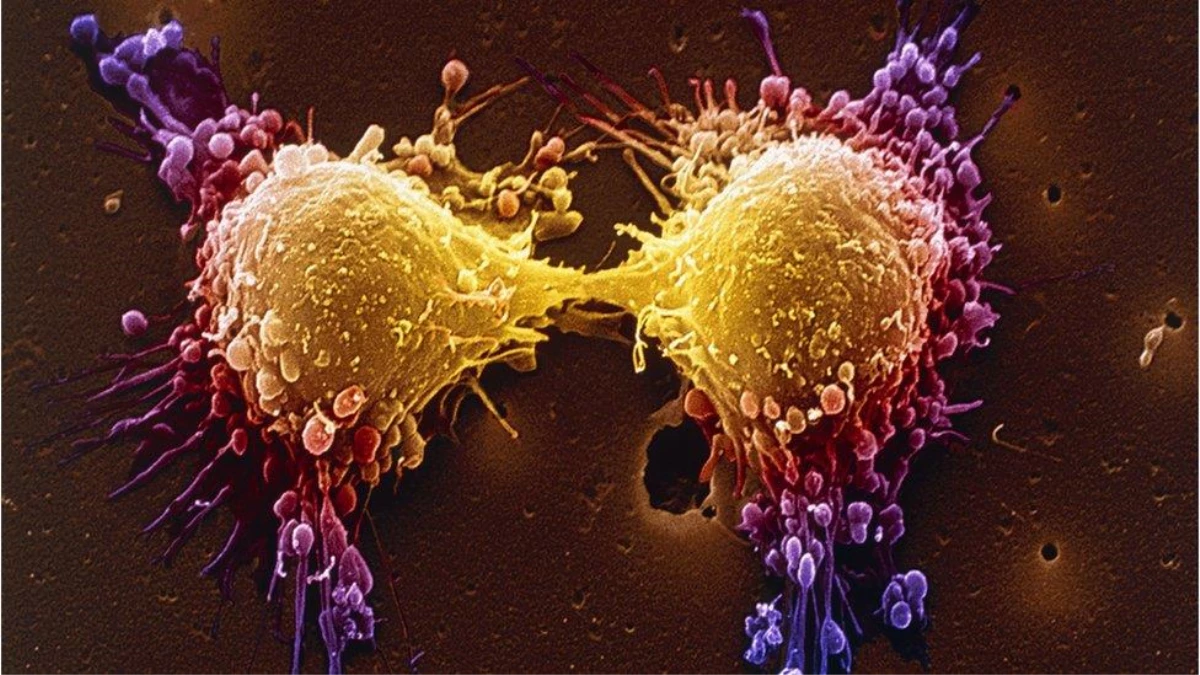 4 Şubat Dünya Kanser Günü: Covid salgını, kanserle mücadeleyi nasıl etkiledi?