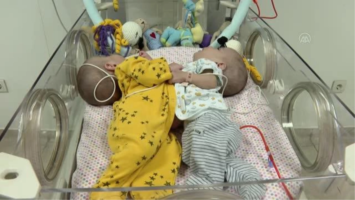 Karın bölgelerinden yapışık olarak dünyaya gelen bebekler, 101 gün sonra ailelerine kavuştu