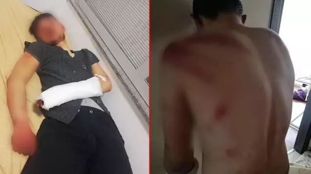 16 ya��ndaki genci, 5 saat boyunca dinlene dinlene d�vd�ler