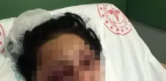 Samsun'da eski eşinin dövdüğü kadın taburcu oldu