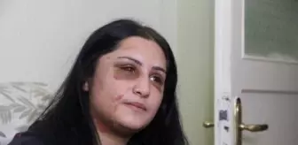 Samsun'da eski eşinin dövdüğü kadın: Şiddet sessiz kalındıkça çoğalıyor