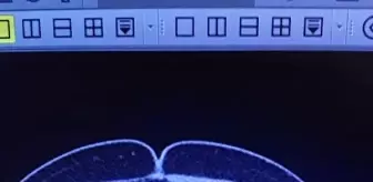 Son dakika haberleri | Van'da, 2 İran uyruklunun midesinden 103 kapsül metamfetamin çıktı