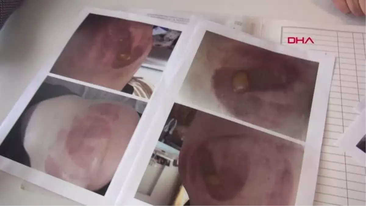 İZMİR Estetik mağduru Mansuroğlu Kadınlar, yeterlilik belgesi olmayan yerlere gitmesin