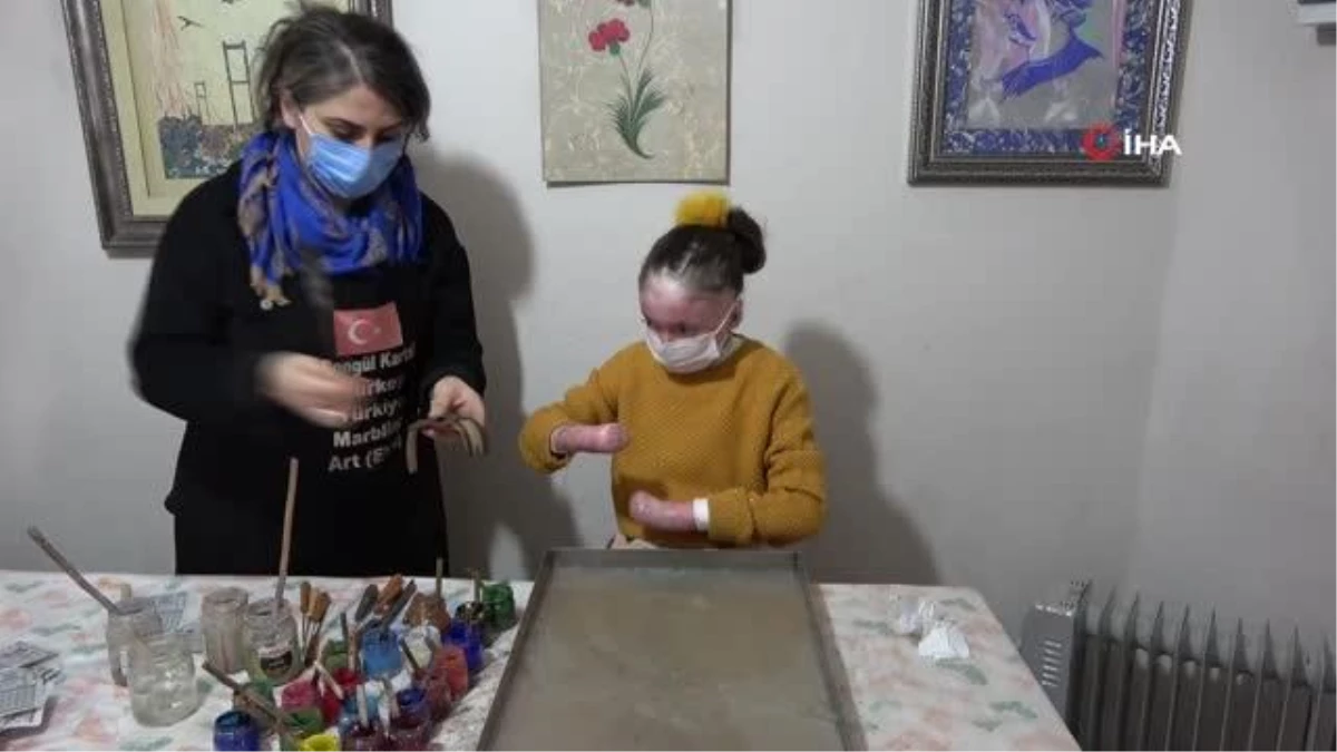 Kelebek hastası genç kız ebru sanatıyla kendine hayran bırakıyor