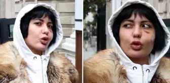 Saldırıya uğrayan Bahar Candan, olayın detaylarını anlattı