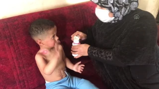 Yemek borusu doğuştan kısa olan Suriyeli Muhammed 2 yıldır ameliyat olmayı bekliyor