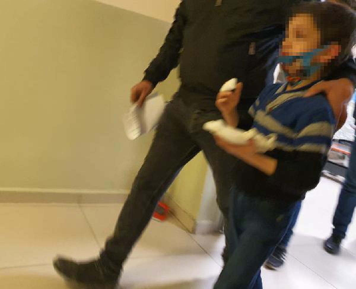Parkta oyun oynayan Suriyeli Ahmet\'in parmağı koptu