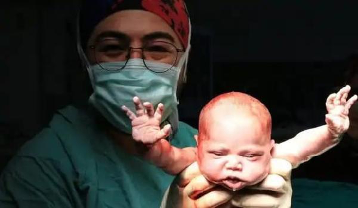 Anestezi teknikeri, Burçak bebeğin fotoğrafıyla birinci oldu