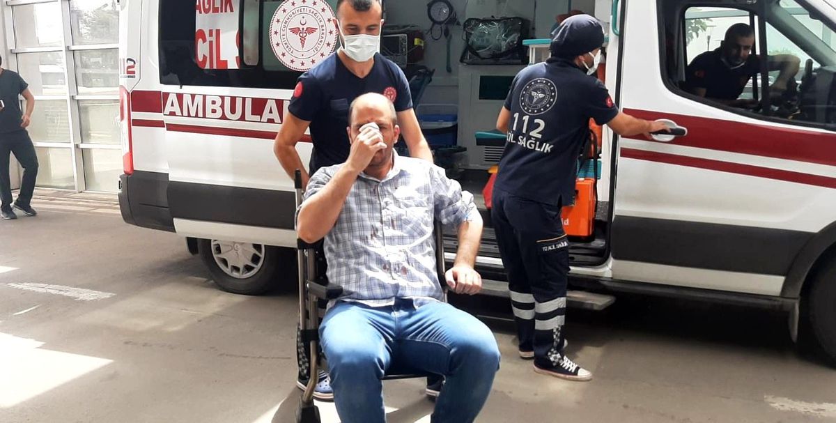 Tazyikli suyla yüzünü kesti