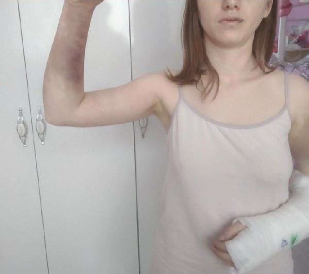 Zeynep\'i beyzbol sopasıyla 18 saat boyunca, aralıklarla döven erkek arkadaşının 25 yıl hapsi istendi