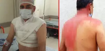 Sigara dumanı yüzünden tartıştığı komşusunun üzerine kaynar su döktü