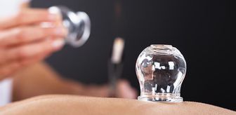 Dernek başkanı, hacamata gelen kadınları taciz etti