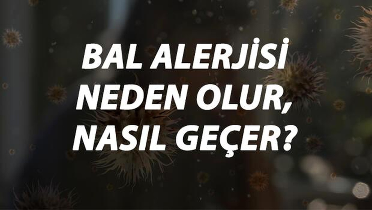 Bal Alerjisi Nedir, Neden Olur ve Nasıl Geçer? Bal Alerjisi Belirtileri ve Tedavisi Hakkında Bilgi