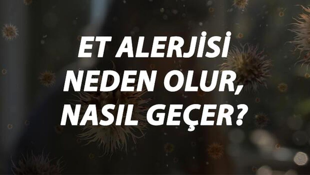 Et Alerjisi Nedir, Neden Olur ve Nasıl Geçer? Et Alerjisi Belirtileri ve Tedavisi Hakkında Bilgi