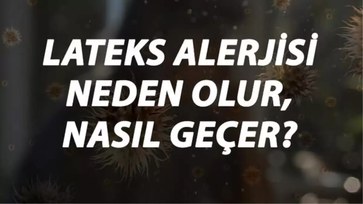 Lateks Alerjisi Nedir, Neden Olur ve Nasıl Geçer? Lateks Alerjisi Belirtileri ve Tedavisi Hakkında Bilgi