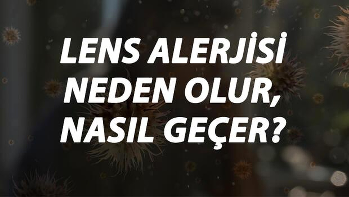 Lens Alerjisi Nedir, Neden Olur ve Nasıl Geçer? Lens Alerjisi Belirtileri ve Tedavisi Hakkında Bilgi