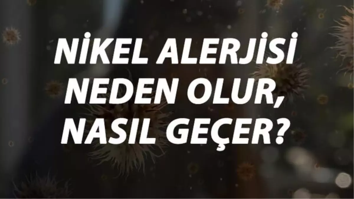 Nikel Alerjisi Nedir, Neden Olur ve Nasıl Geçer? Nikel Alerjisi Belirtileri ve Tedavisi Hakkında Bilgi