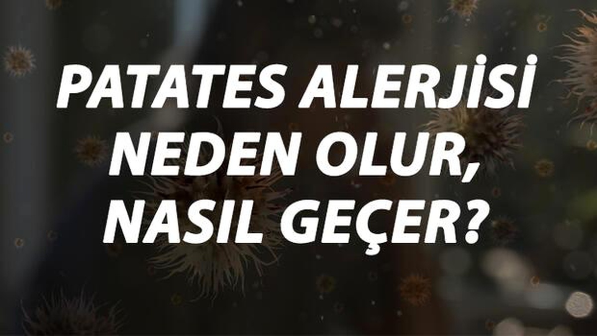 Patates Alerjisi Nedir, Neden Olur ve Nasıl Geçer? Patates Alerjisi Belirtileri ve Tedavisi Hakkında Bilgi
