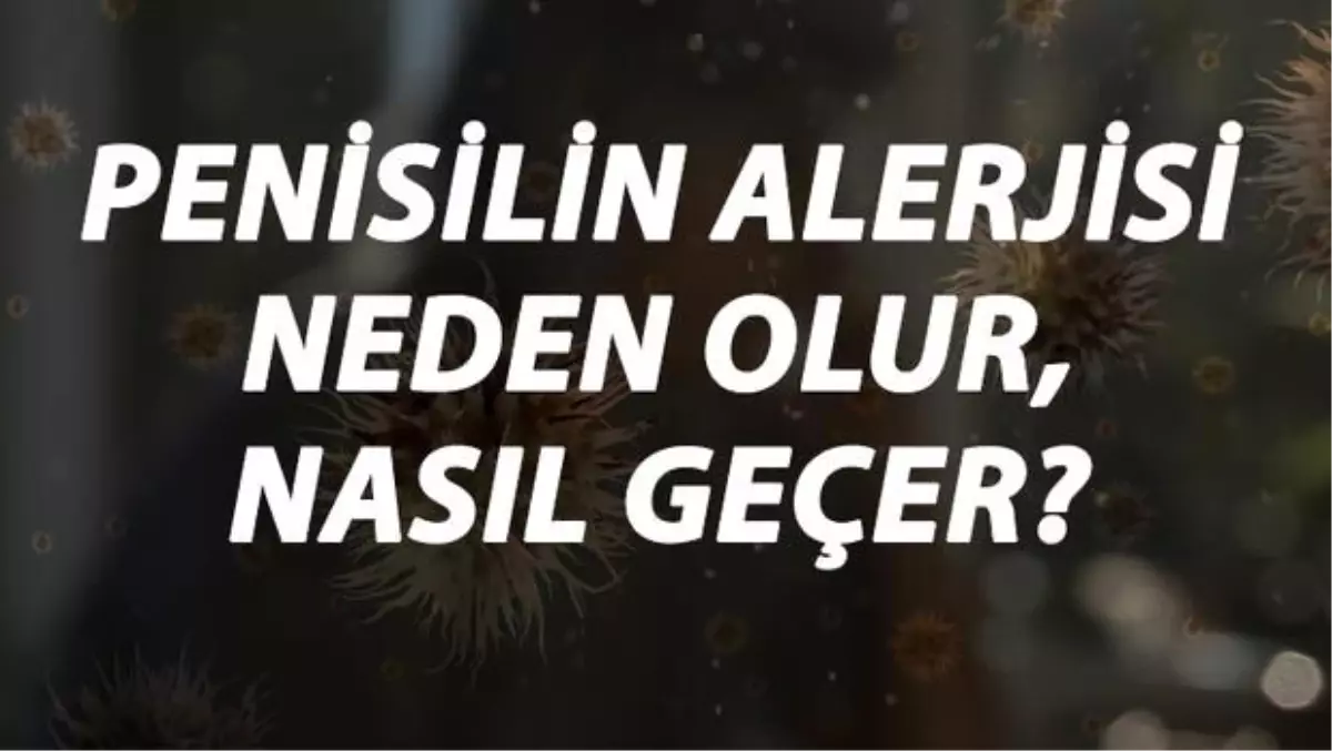 Penisilin Alerjisi Nedir, Neden Olur ve Nasıl Geçer? Penisilin Antibiyotik Alerjisi Belirtileri ve Tedavisi Hakkında Bilgi