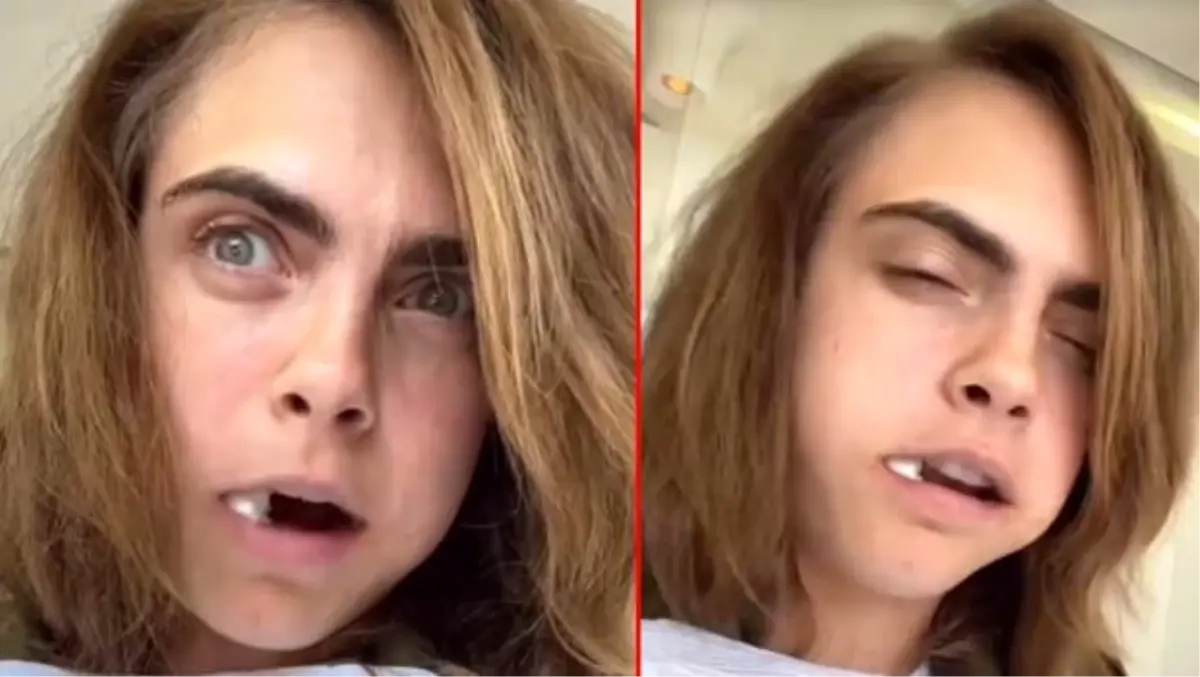 Cara Delevingne, operasyon koltuğundan seslendi: Çok ağladım