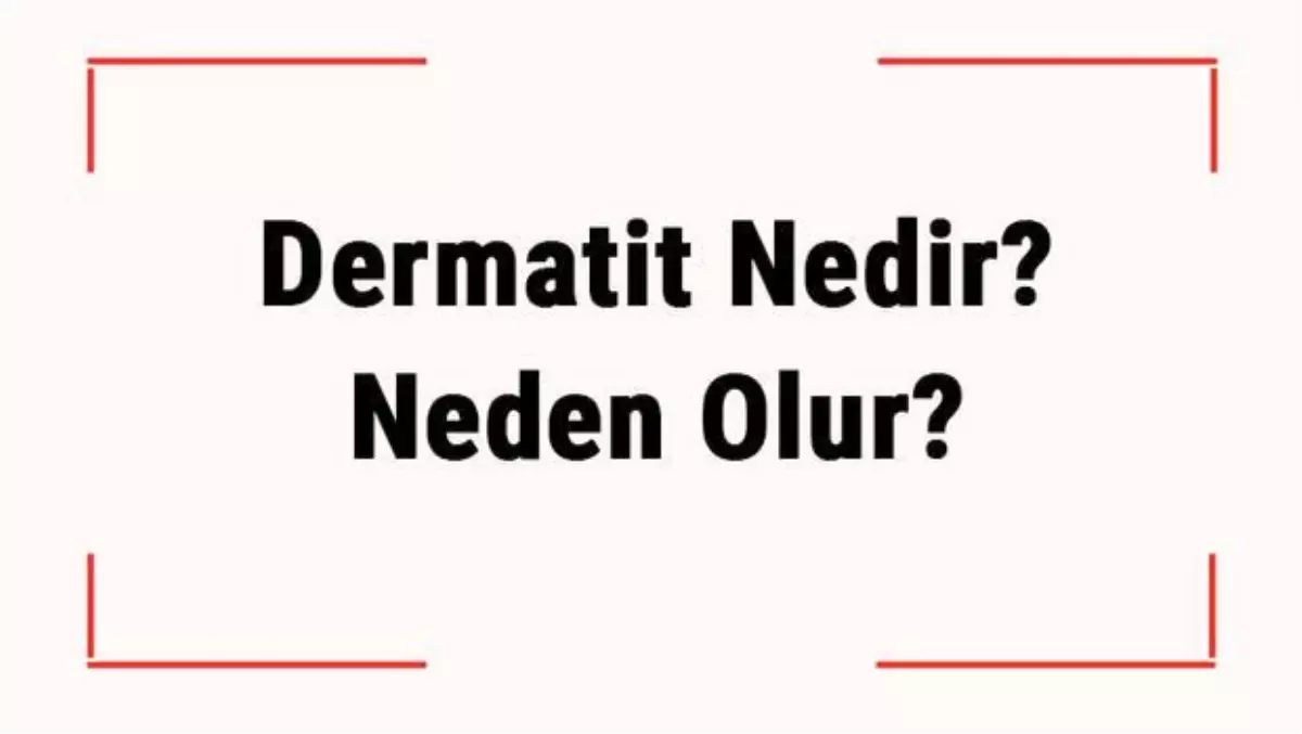 Dermatit Nedir? Neden Olur? Dermatit Nasıl Tedavi Edilir?